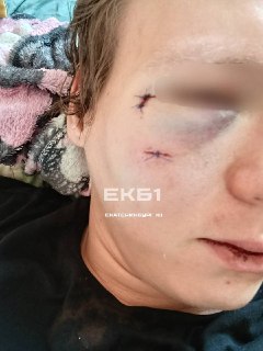 Екатеринбуржец стал жертвой нападения на остановке общественного транспорта